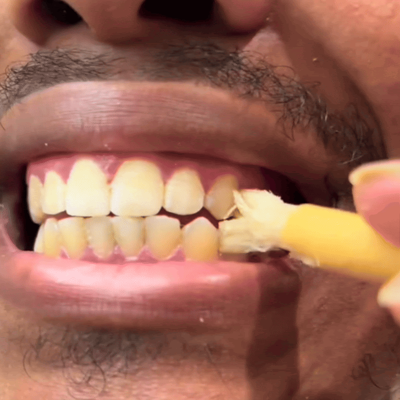 Enamel biological remineralization