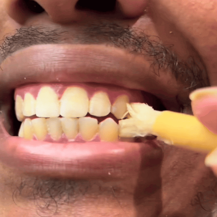 🌿 Miswak — Nature’s Original 7,000-Year-Old Toothbrush